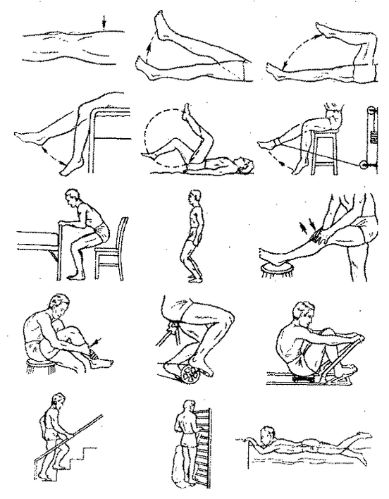 Therapeutic exercises for arthrosis of the knee joint