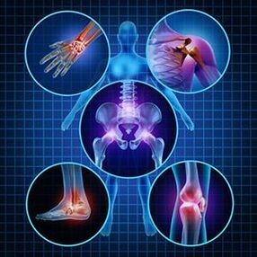 how to facilitate the mobility of the joints with arthritis and arthrosis in treatment